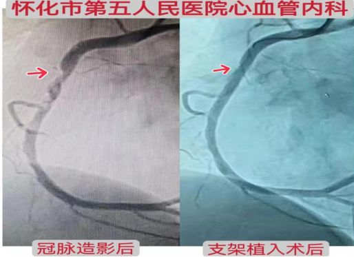 1648345882281863.png image.png