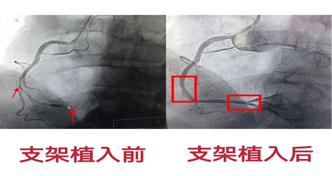图片3(1).png